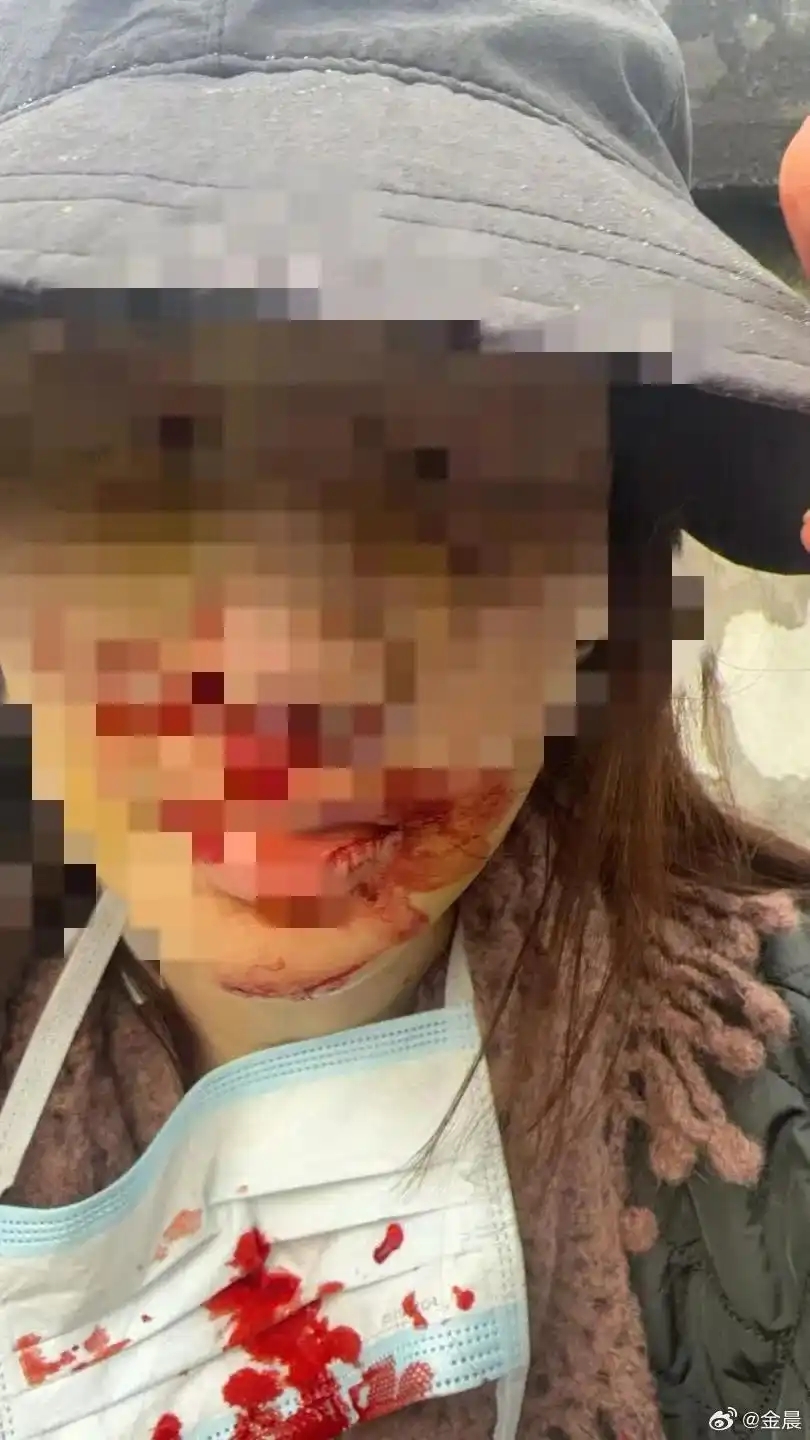 金晨回应驾车事故并致歉