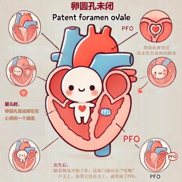 广州医科大学附属口腔医院黄牛号贩子票贩子代网上预约代挂号电话科普|卵圆孔未闭:心脏里的“小门”没关好?