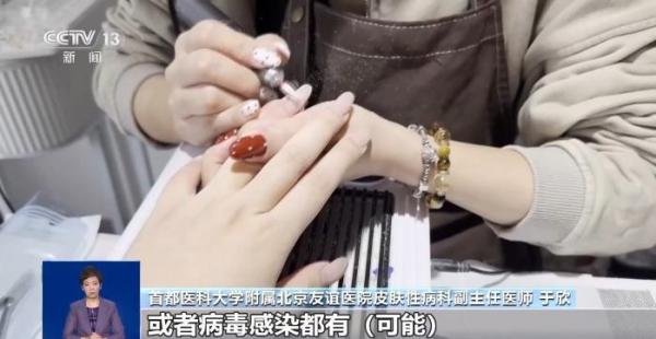 
上海曙光医院黄牛号贩子票贩子代网上预约代挂号电话美甲暗藏健康隐患 这几类人群要格外注意