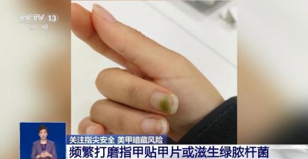 
上海曙光医院黄牛号贩子票贩子代网上预约代挂号电话美甲暗藏健康隐患 这几类人群要格外注意