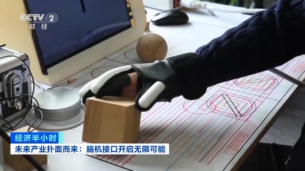 
医学科学院肿瘤医院黄牛号贩子票贩子代网上预约代挂号电话瘫痪17年重获新生 中国首例脑机接口植入患者能下棋了