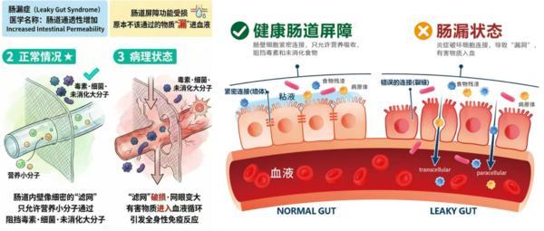 
北京安贞医院赵全明温绍君宋跃顾承雄李刚闫军黄牛挂号电话科学指引健康，掌握身体自主权：万益蓝专利源护菌GOLDGUT-M520如何唤醒“妈生免疫”？