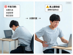 广东省人民医院刘方舟曾平崔虎军李戚元丽黄牛挂号电话两名青少年患上腰突