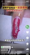 解放军总医院医院黄牛号贩子票贩子代网上预约代挂号电话测评IP被30家店铺“
